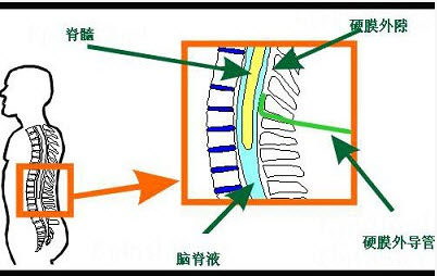 黄韧带位置研究取得最新进展